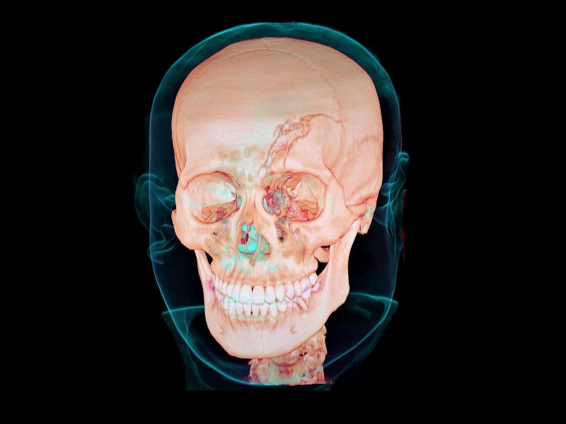 Read more about the article Facial Trauma and Reconstruction with Nevada OMS, Your Trusted Oral Surgeons in Las Vegas